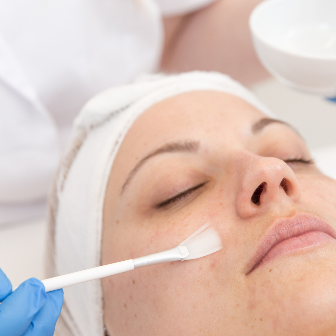 Professional exfoliation and Vitamin C