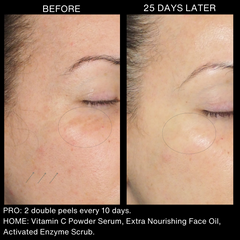 DOUBLE PEEL - GROWTH KITS