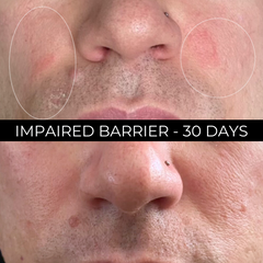 Retinal Azelaic Powder Serum