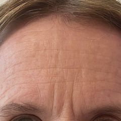 HA B3 Powder Serum