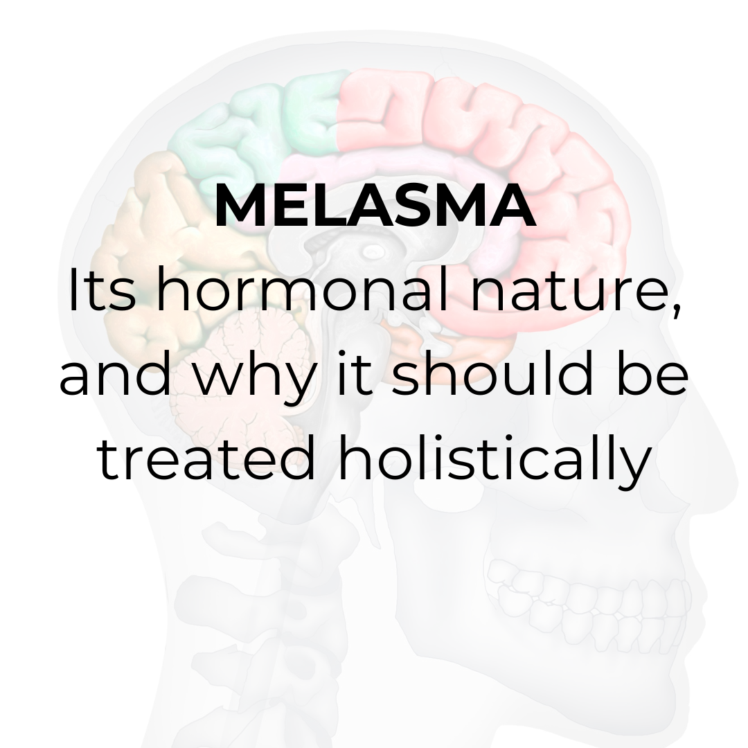 Melasma: Its hormonal nature, and why it should be treated holistically