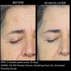 DOUBLE PEEL - GROWTH KITS