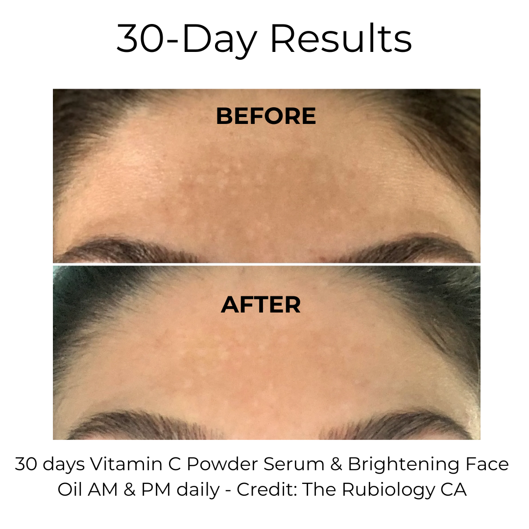 Suero de vitamina C en polvo 