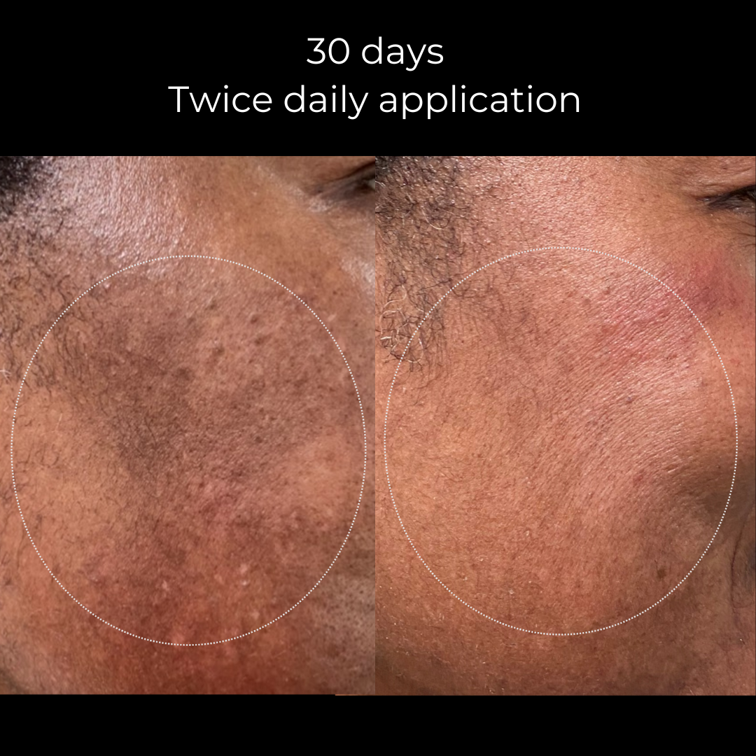 Trío iluminador - avanzado - ahorra $16