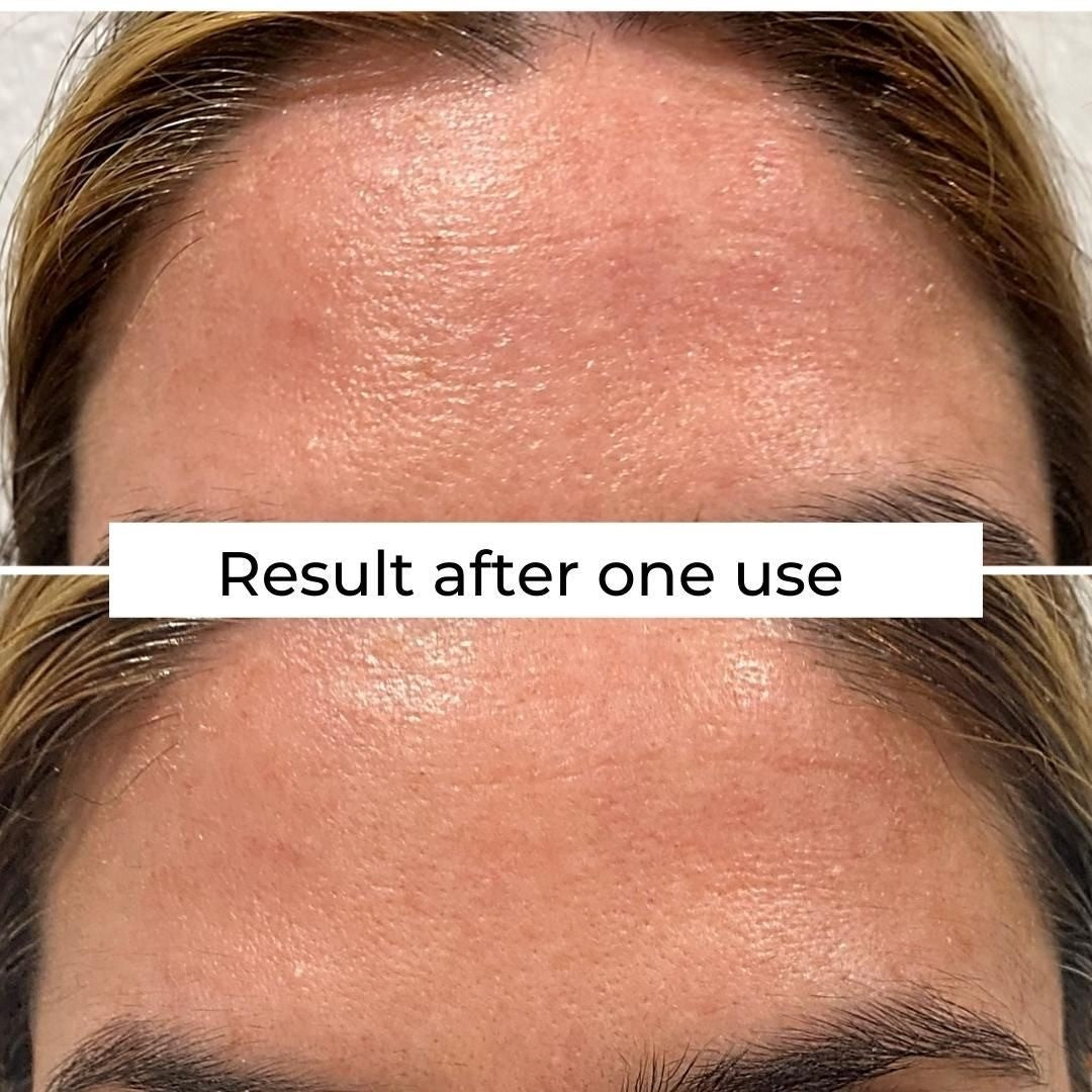 Exfoliante de enzimas activadas